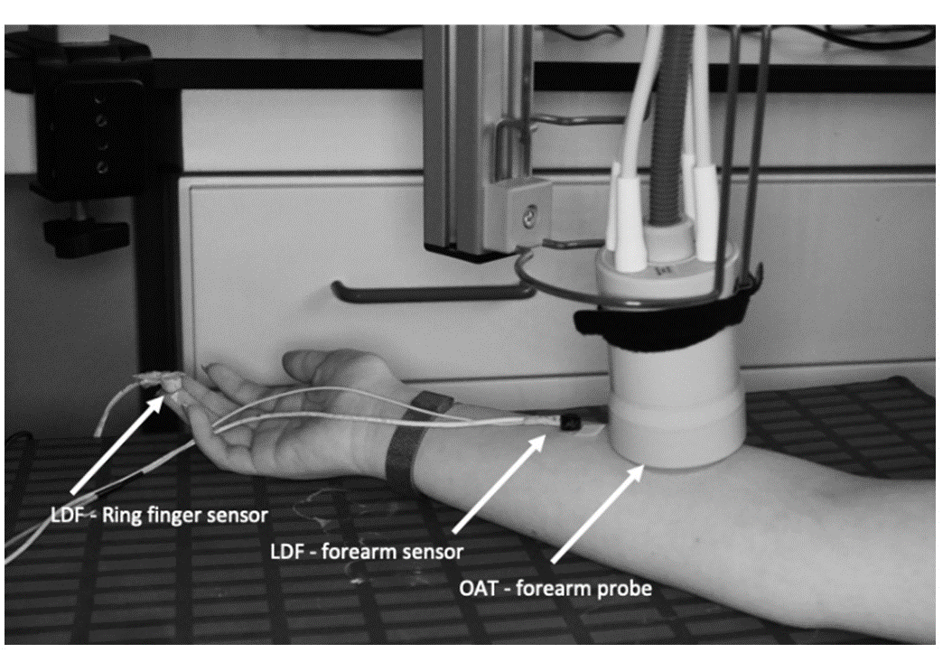 Figure 1 - LDF sensors and OAT probe setting prior to the PORH maneuverer.